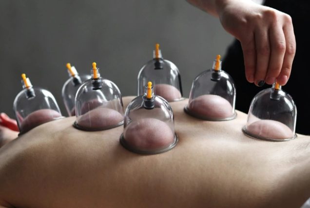 Séance de Hijama Therapy